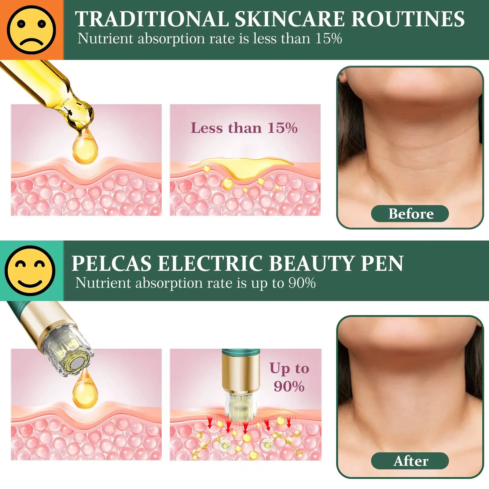 القلم الصغير للعناية بالبشرة -Mini Skin Care Pen Beauty Device