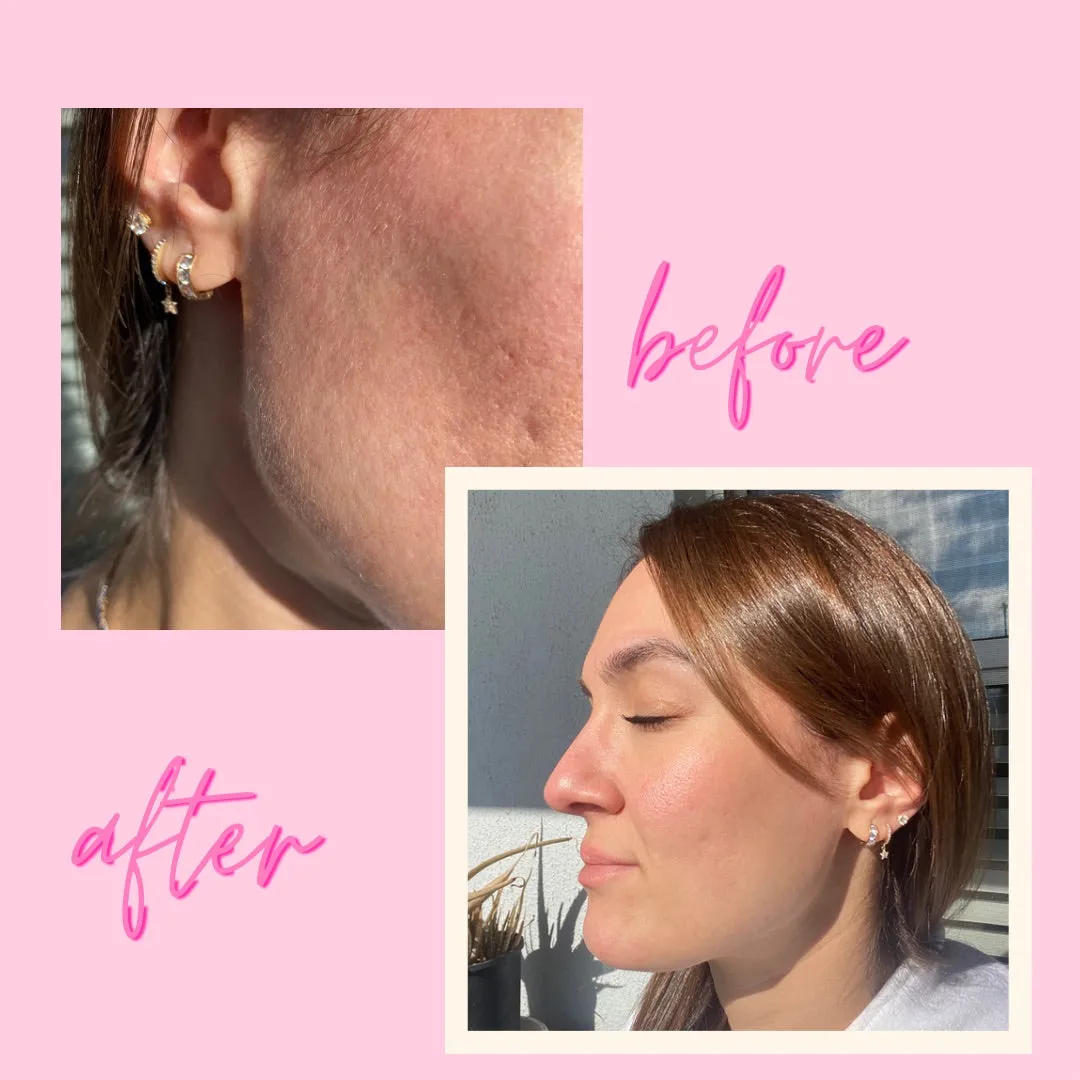PeachRaze - Eco-Friendly Dermaplaning Razor ( 3 razors- On The Go )
